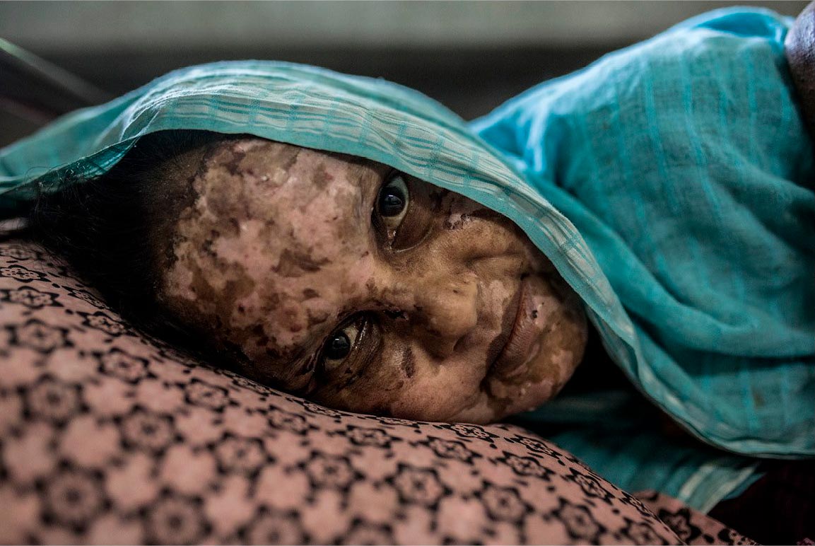 Rohingyas_escapandodelgenocidio_2000x