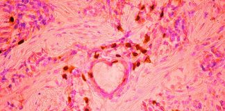 © Malgorzata Lisowska – Tercer premio