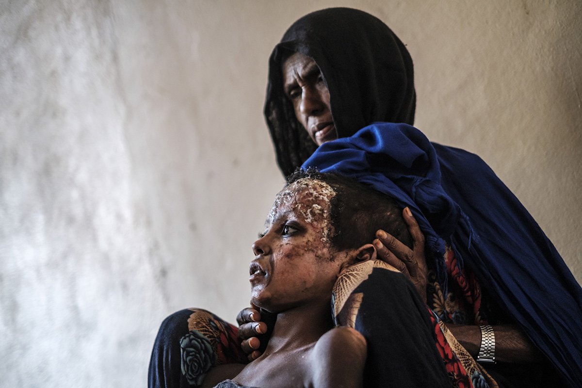 ETHIOPIA-