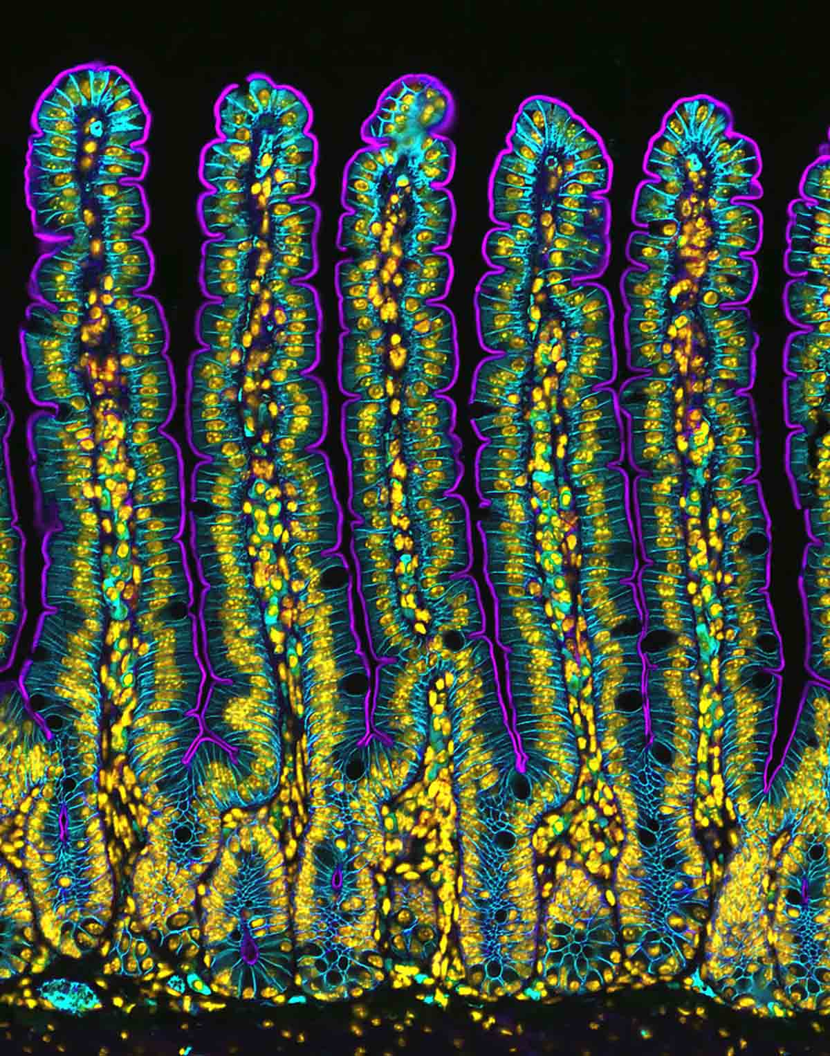 Nikon's Small World 2024