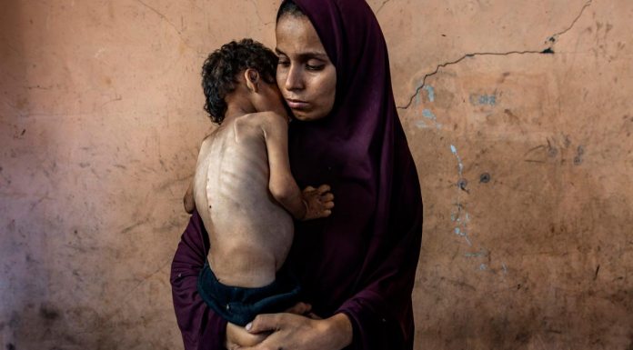 Pulitzer de fotografía 2026: estas son las duras imágenes seleccionadas entre las mejores historias documentales del año Pulitzer_Saher-Alghorra_Gaza_07_0
